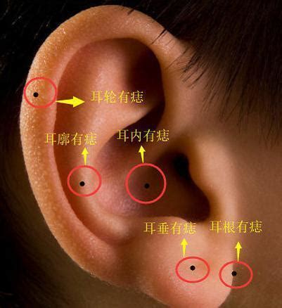 小耳朵有痣|耳朵长痣的位置图解 耳朵长痣的位置图解有福气